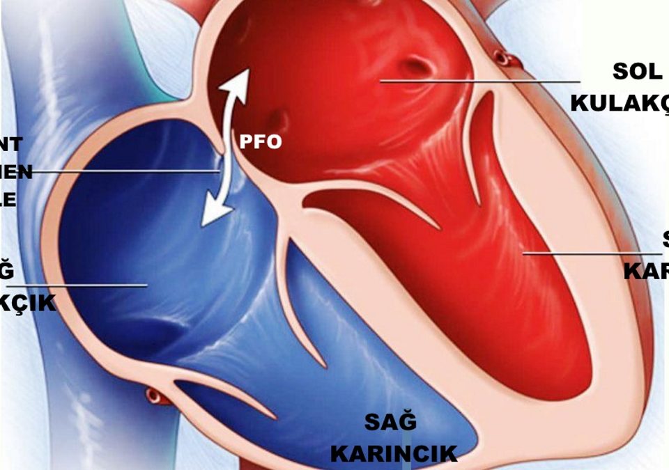romatizmal kalp hastalıkları için sağlık eğitimi
